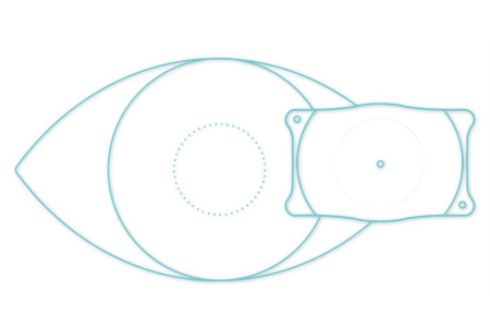 做ICL晶體可以報什么兵種呢？